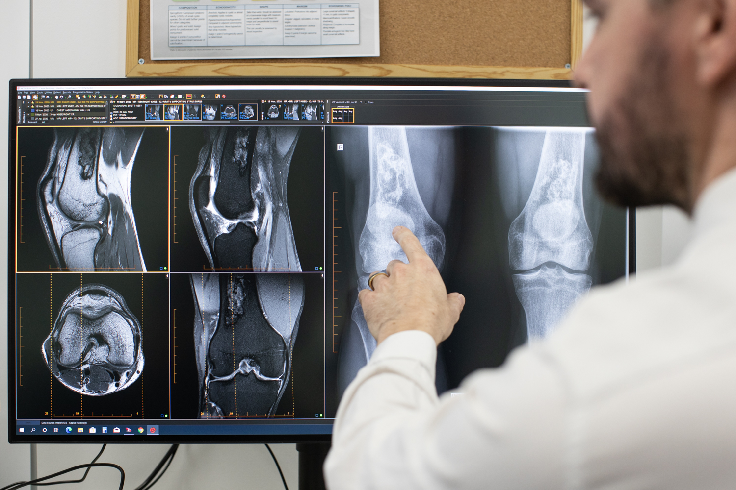 Male Doctor Explaining X ray Results to Patient | Australia Radiology Clinic | Radiology Tasmania